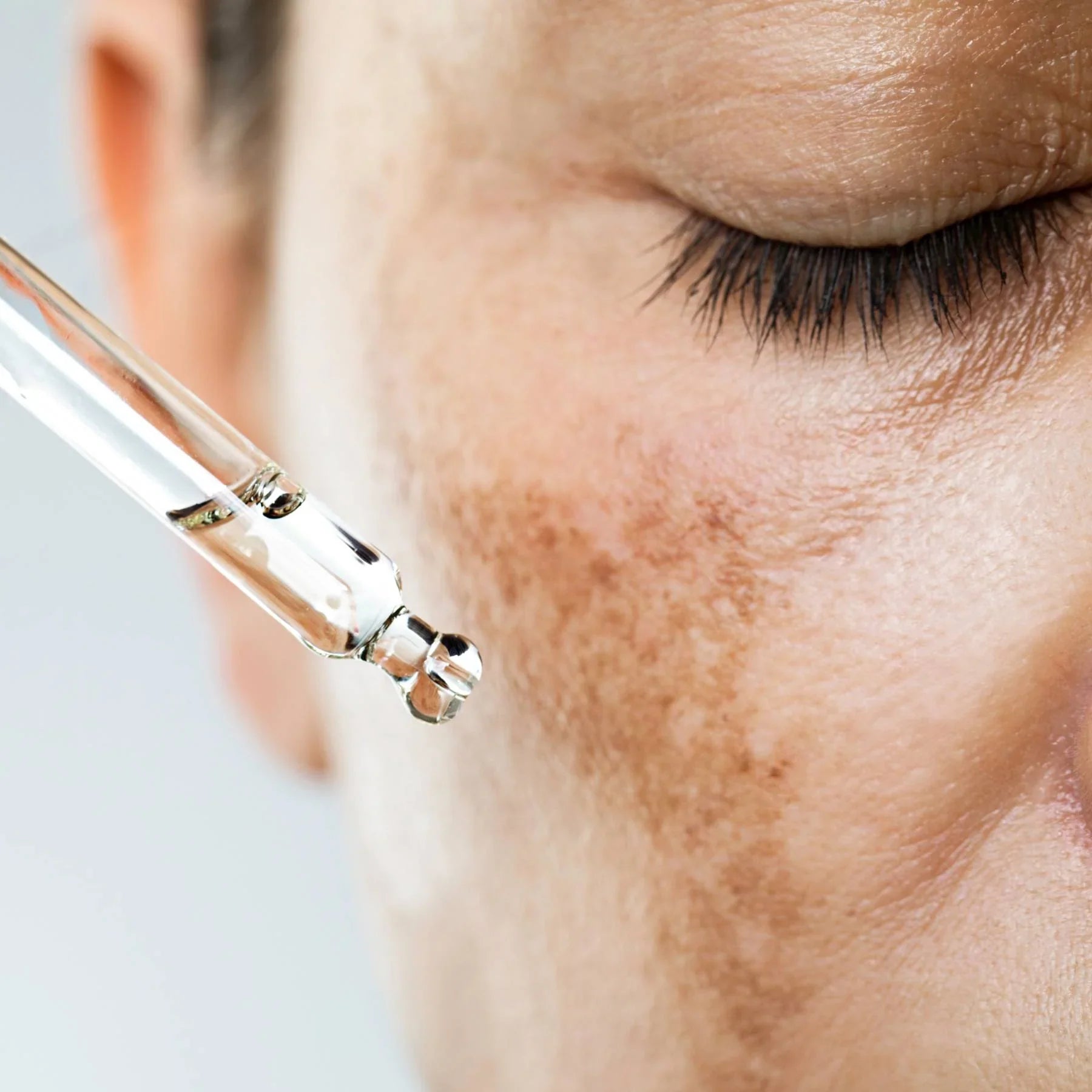 Woman applying serum on pigmentation skin